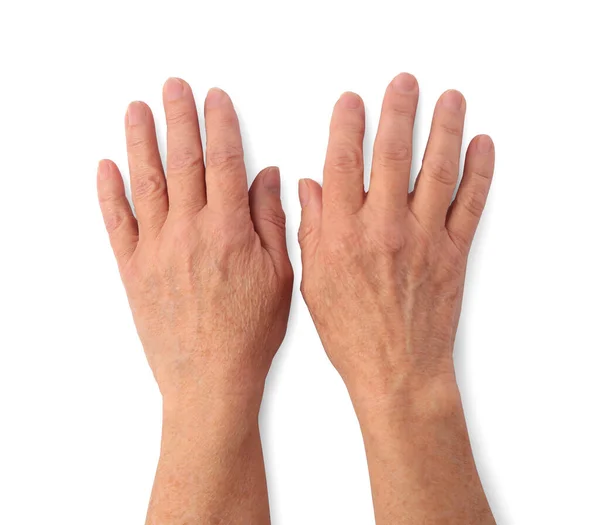 Closeup View Woman Hands Aging Skin Top View — Stock Photo, Image