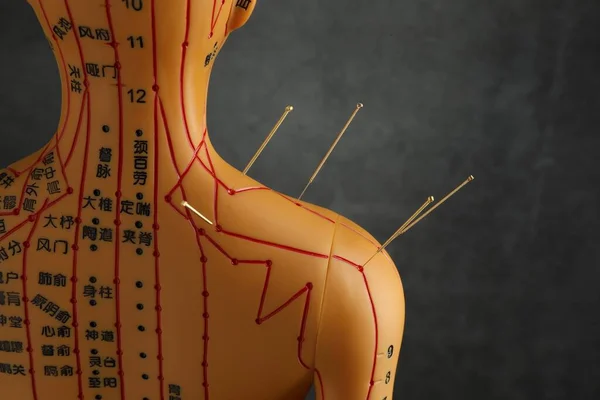 Akupunktura Medycyna Alternatywna Ludzki Model Igłami Ramieniu Pobliżu Ciemnoszarego Tła — Zdjęcie stockowe