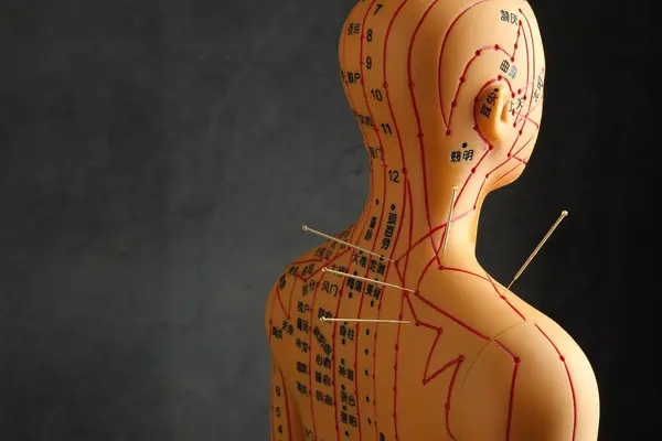 Acupuncture - alternative medicine. Human model with needles in shoulder against dark grey background, space for text