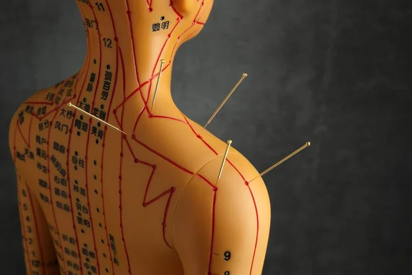 Akupunktura Medycyna Alternatywna Model Ludzki Igłami Ramieniu Pobliżu Ciemnoszarego Tła — Zdjęcie stockowe