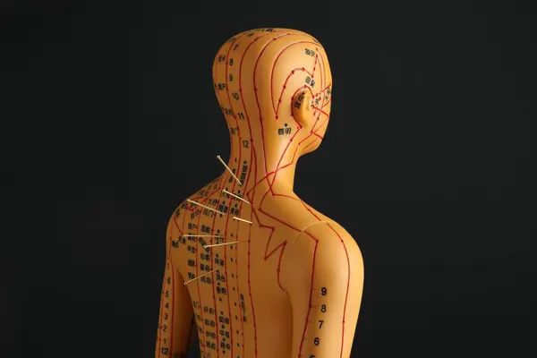 Acupunctuur Alternatieve Geneeskunde Menselijk Model Met Naalden Rug Tegen Zwarte — Stockfoto
