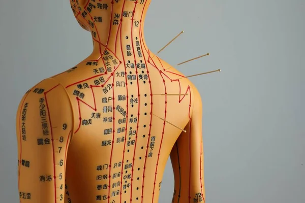 Akupunktura Alternativní Medicína Lidský Model Jehlami Rameni Proti Šedému Pozadí — Stock fotografie
