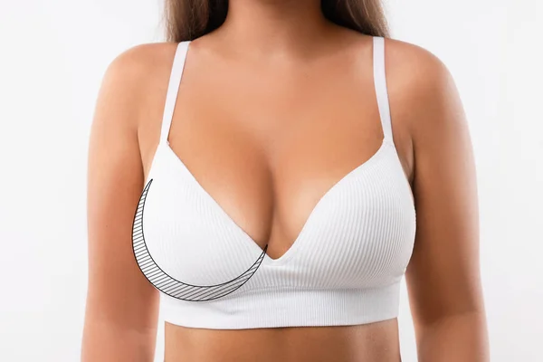 Woman Breast Asymmetry White Background Closeup — Stock Photo, Image