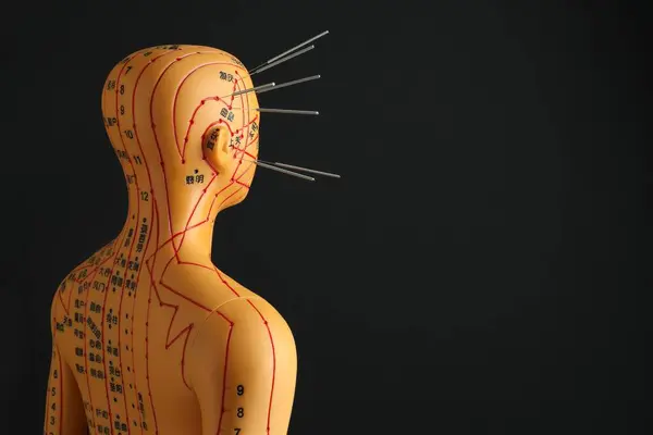 Acupuncture - alternative medicine. Human model with needles in head on black background, space for text
