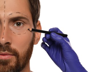 Beyaz arkaplanda estetik ameliyat için kalem hazırlayan bir doktor, yakın plan.