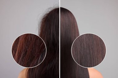 Kadın fotoğrafı gri arka planda saç tedavisinden önce ve sonra ikiye bölünmüş. Yakınlaştırılmış alan hasarlı ve sağlıklı iplikleri gösteriyor