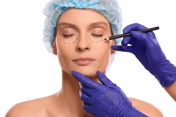 Lékař Tužkou Připravuje Pacienta Kosmetickou Chirurgii Bílém Pozadí Detailní Záběr — Stock fotografie