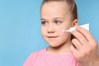 Baba, açık mavi arka planda kızının yanağına merhem sürüyor.