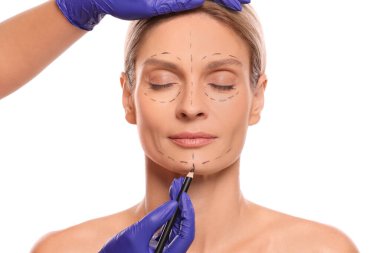 Doctor with pencil preparing patient for cosmetic surgery operation on white background, closeup clipart