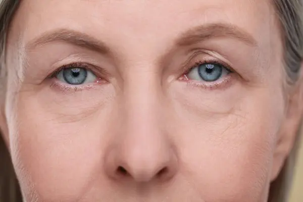 Närbild Äldre Kvinnas Ansikte Med Åldrande Hud — Stockfoto
