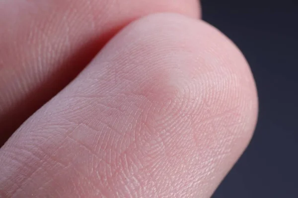 摩擦リッジ付きの指のマクロビュー — ストック写真
