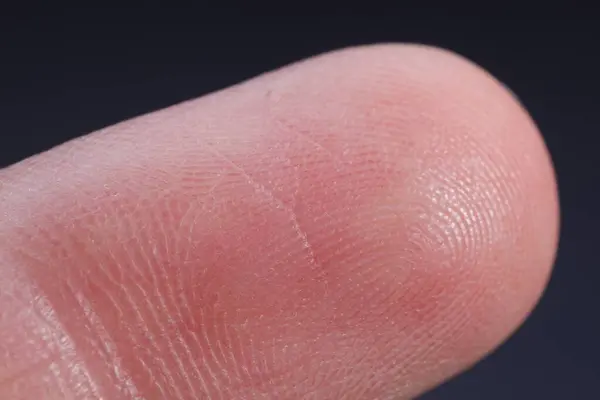 Prst Třecími Hranami Tmavém Pozadí Makro Pohled — Stock fotografie