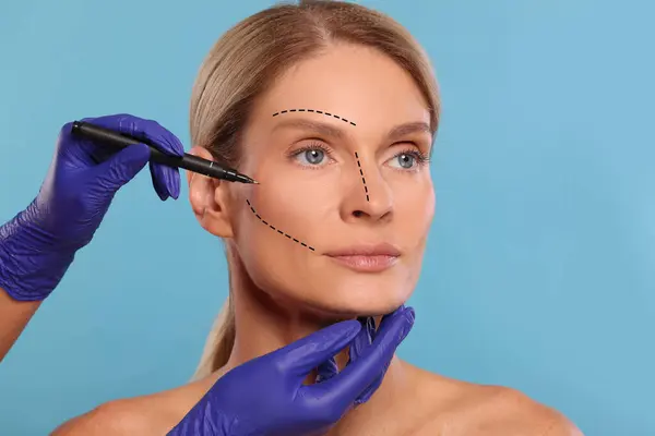 Woman preparing for cosmetic surgery, light blue background. Doctor drawing markings on her face, closeup