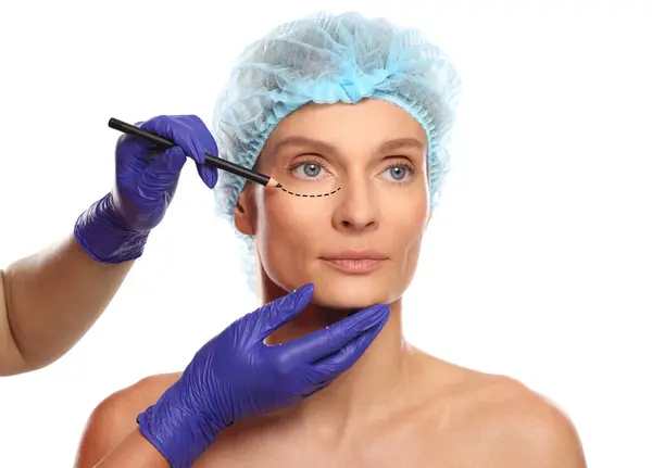 Žena Připravuje Kosmetickou Operaci Bílé Zázemí Doktorské Kresby Její Tváři — Stock fotografie