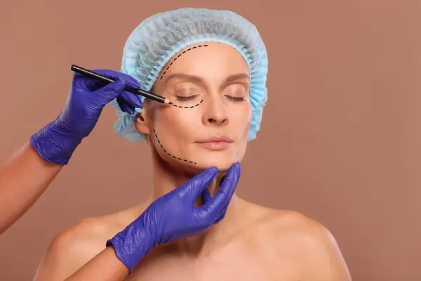 Woman preparing for cosmetic surgery, light brown background. Doctor drawing markings on her face, closeup