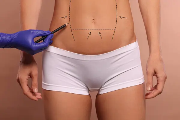 Woman preparing for cosmetic surgery, light brown background. Doctor drawing markings on her abdomen, closeup
