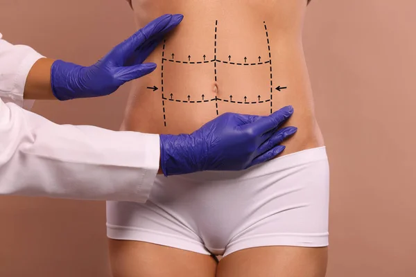 Doctor and patient preparing for cosmetic surgery, light brown background. Woman with markings on her abdomen, closeup