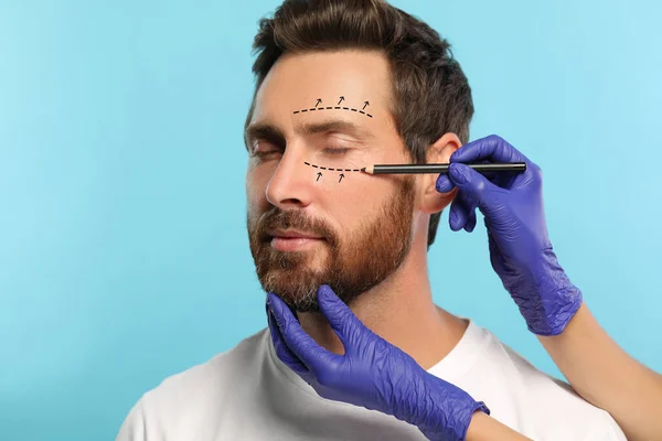Man preparing for cosmetic surgery, light blue background. Doctor drawing markings on his face, closeup