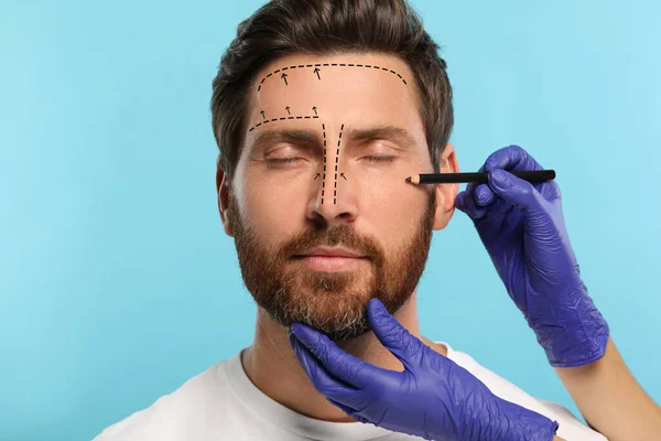 Man preparing for cosmetic surgery, light blue background. Doctor drawing markings on his face, closeup