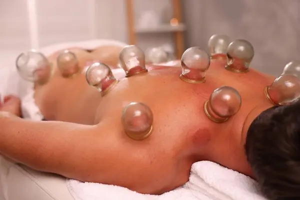 Cupping therapy. Closeup view of man with glass cups on his back in spa salon