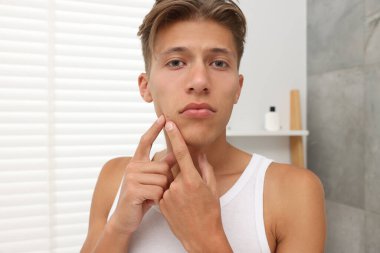 Kapalı mekanda sivilce çıkaran genç bir adam. Sivilce sorunu