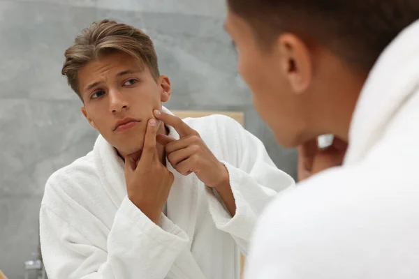 鏡を見つめている若い男が 屋内で顔にピンプルを浮かべた アクネ問題 — ストック写真