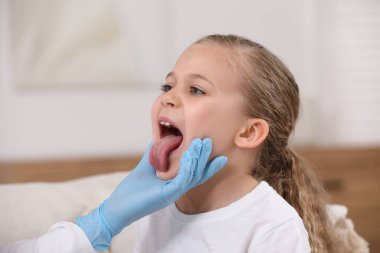 Eldivenli doktor, kızın ağız boşluğunu içeride inceliyor.