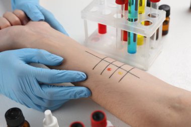 Klinikteki ışık masasında deri alerjisi olan hasta, yakın plan.