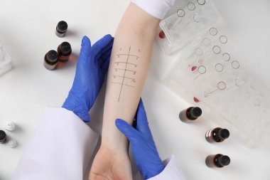 Doktor ışık masasında cilt alerjisi testi yapıyor.