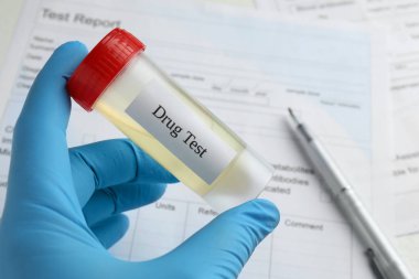 Uyuşturucu testi. Laboratuvar çalışanı elinde idrar örneğiyle birlikte masayı kapatıyor.