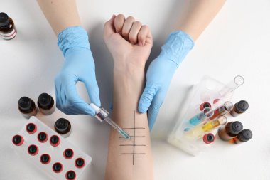Doktor ışık masasında cilt alerjisi testi yapıyor.