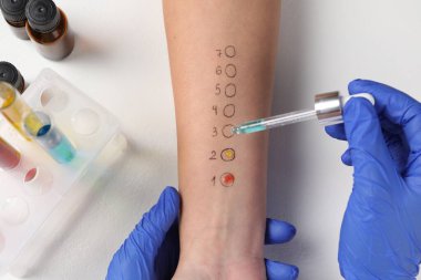 Doktor ışık masasında cilt alerjisi testi yapıyor.
