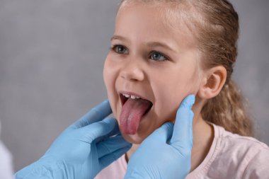 Tıbbi eldivenli doktor gri arka planda kızın ağız boşluğunu inceliyor, yakın plan.