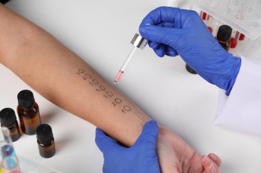 Doktor ışık masasında cilt alerjisi testi yapıyor, yakın plan.