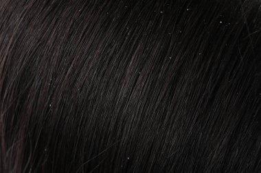 Koyu renk saçlı kepekli kadının yakın görüntüsü.