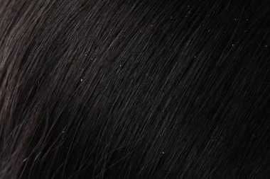 Koyu renk saçlı kepekli kadının yakın görüntüsü.