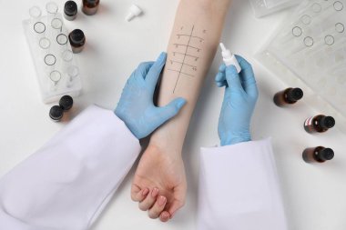 Doktor ışık masasında cilt alerjisi testi yapıyor.