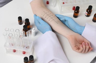 Doktor ışık masasında cilt alerjisi testi yapıyor, yakın plan.