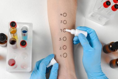 Doktor ışık masasında cilt alerjisi testi yapıyor.