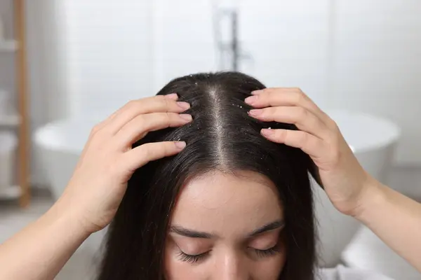 Woman examining her hair and scalp at home, closeup. Dandruff problem