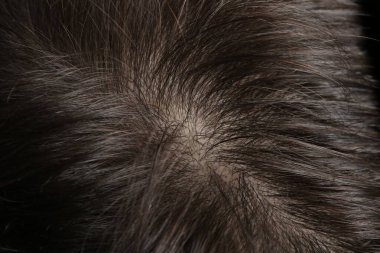 Sağlıklı koyu saçlı, makro manzaralı bir adam.