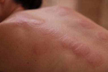 Kapalı mekandaki terapiden sonra kadının yakın görüntüsü