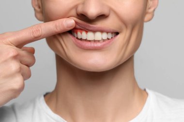 Woman showing inflamed gum on grey background, closeup clipart