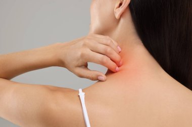 Alerji yüzünden acı çekiyor. Açık gri arka planda boynunu kaşıyan genç bir kadın.