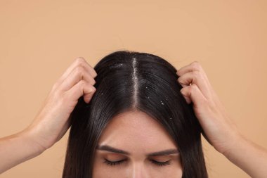 Saçını ve kafa derisini bej arka planda inceleyen kadın, yakın plan. Kepek problemi.