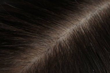 Sağlıklı koyu saçlı, makro manzaralı bir adam.