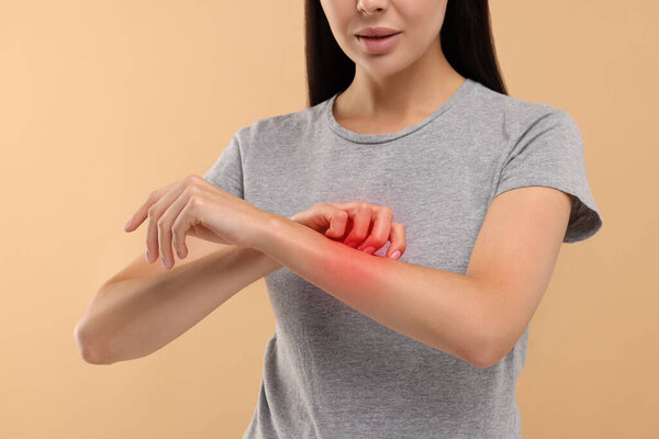 Young woman scratching her arm on beige background, closeup