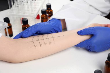 Doktor ışık masasında cilt alerjisi testi yapıyor, yakın plan.