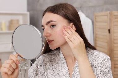 Cilt sorunu olan genç bir kadın banyodaki aynaya bakıyor.