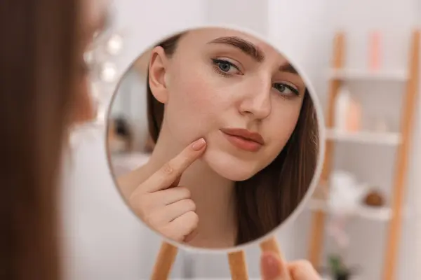 Young woman with skin problem looking at mirror indoors, closeup